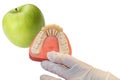 Dentures and apple on white background Royalty Free Stock Photo