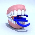 Denture and euro symbol