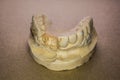 Denture impression made of plaster with implants Royalty Free Stock Photo