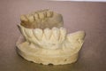 Denture impression made of plaster with implants Royalty Free Stock Photo