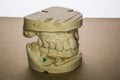 Denture impression made of plaster with implants Royalty Free Stock Photo