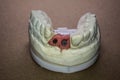 Denture impression made of plaster with implants Royalty Free Stock Photo