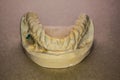 Denture impression made of plaster with implants Royalty Free Stock Photo