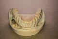 Denture impression made of plaster with implants Royalty Free Stock Photo