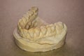 Denture impression made of plaster with implants Royalty Free Stock Photo