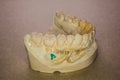 Denture impression made of plaster with implants Royalty Free Stock Photo