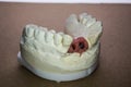 Denture impression made of plaster with implants Royalty Free Stock Photo