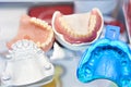 Denture molds Royalty Free Stock Photo