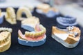 Denture treatment, dental implants closeup