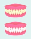 Denture in two health states. Dental implant with different teeth colors. Sick and healthy teeth jaw. Medical items.