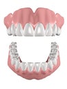 Dentures Royalty Free Stock Photo