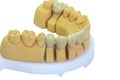 Dentures with porcelain teeth Royalty Free Stock Photo