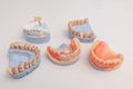Dentures on a white background. Close-up of dentures. Full removable plastic denture of the jaws. Prosthetic dentistry. False Royalty Free Stock Photo