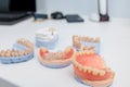 Dentures on a white background. Close-up of dentures. Full removable plastic denture of the jaws. Prosthetic dentistry. False Royalty Free Stock Photo