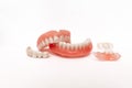 Dentures on a white background. Close-up of dentures. Full removable plastic denture of the jaws. Prosthetic dentistry. Royalty Free Stock Photo