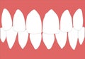 Dentures With White Teeth. The Gums Of The Upper And Lower Jaw Isolated On A White Background. Vector Illustration. Stomatology Royalty Free Stock Photo