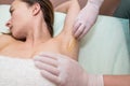 Depilation and epilation female armpit with liquid sugar paste by spatula. Hand of cosmetologist applying wax paste on armpit Royalty Free Stock Photo