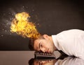 Stressed business man head is burning Royalty Free Stock Photo