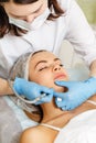 Dermabrasion face. Hardware cosmetology. Royalty Free Stock Photo