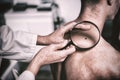 Dermatologist examining mole with magnifying glass Royalty Free Stock Photo