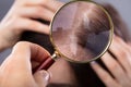 Dermatologist Examining Woman`s Hair Royalty Free Stock Photo