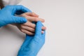 Dermatologist wearing medical gloves examines child hand with viral warts, thinks through course treatment,close-up