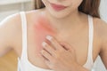 Dermatology, asian young woman, girl allergy, allergic reaction from atopic, insect bites on her body, hand in scratching itchy, Royalty Free Stock Photo