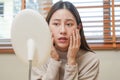 Dermatology, puberty asian young woman, girl looking into mirror, allergy presenting an allergic reaction from cosmetic, red spot Royalty Free Stock Photo