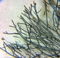 Dermatophyte fungual mycelium and Candida under the microscope Royalty Free Stock Photo