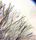 Dermatophyte fungual mycelium under the microscope Royalty Free Stock Photo