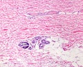 Dermis of thin skin. Hematoxylin-eosin