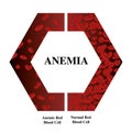 Anemia amount of red blood Iron deficiency anemia difference of Anemia amount of red blood cell and normal symptoms vector illustr