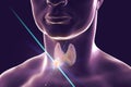 Destruction of thyroid tumor