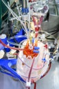 Heart lung machine blood oxygenator