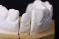 Detail dental wax model Royalty Free Stock Photo