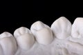 Detail dental wax model