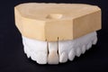 Detail dental wax model Royalty Free Stock Photo