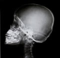 Detail of neck and head x-ray