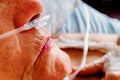 Detail of a patient breathing oxygen through a plastic nasal cannula, elderly woman with breathing problems in a hospital