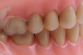 detail plastic teeth