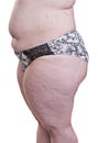 Detail of the side torso girl with obesity Royalty Free Stock Photo