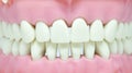 Teeth and gums on dentist model, oral and dental hygiene Royalty Free Stock Photo