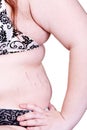 Detail of the trunk of a girl with obesity Royalty Free Stock Photo