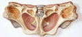 Anatomical Cross-Section of Hip Joint with Endoprosthesis for Medical Education and Surgical Insight Royalty Free Stock Photo