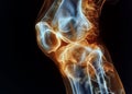 A detailed anatomical illustration of a knee and hand joint affected by osteoarthritis Royalty Free Stock Photo