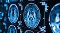 Detailed Brain Scan Comparison Highlighting Key Differences