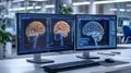 Detailed Brain Scans on Modern Computer Monitors in Bright Office - Generative AI Royalty Free Stock Photo