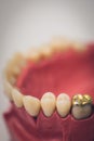 Detailed close up of dental denture or teeth on a table