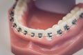 Detailed close up of dental denture or teeth on a table