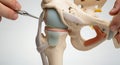 Close Up Hip Joint Surgery on Model with White Background Medical Demonstration of Hip Replacement Procedure Anatomy Display of Royalty Free Stock Photo